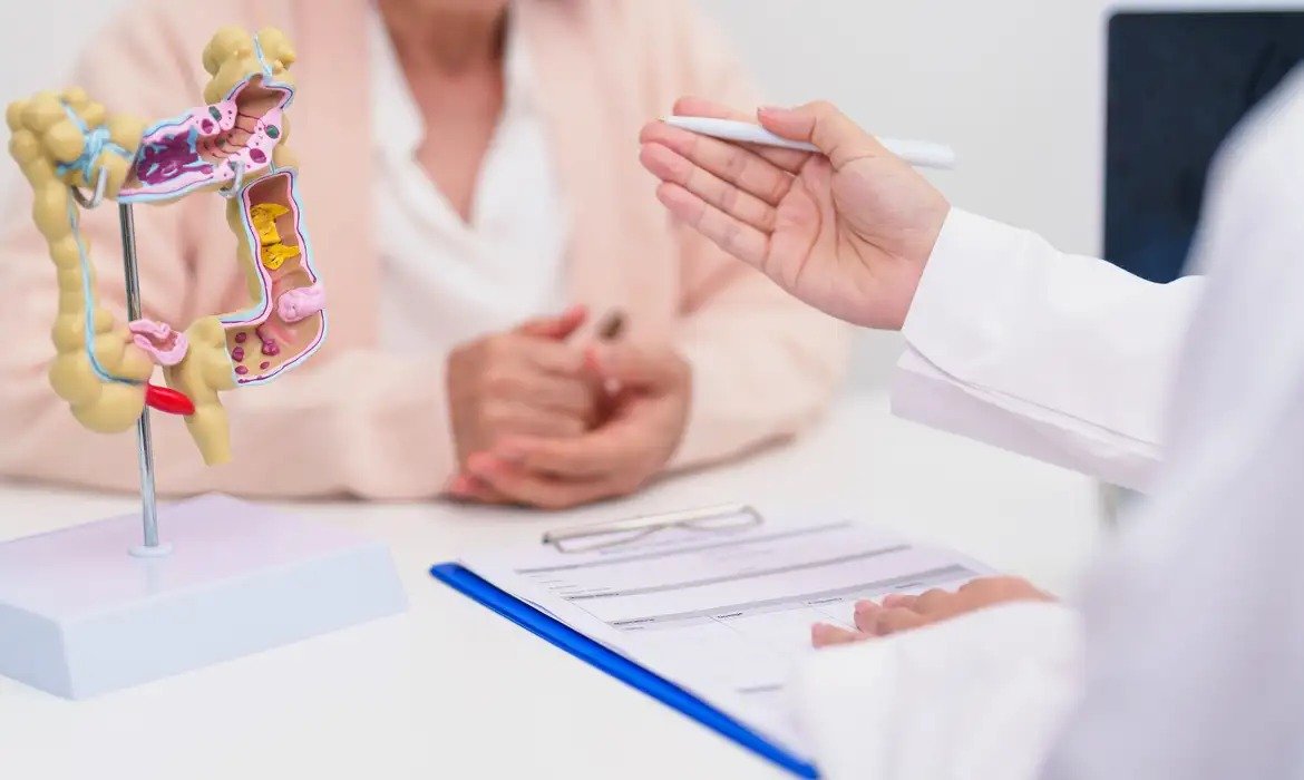 Teste FIT identifica pequenas quantidades de sangue oculto nas fezes e será utilizado no rastreamento do câncer colorretal pelo SUS.